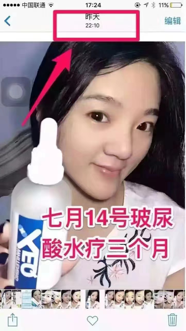 老包装德沃玻尿酸